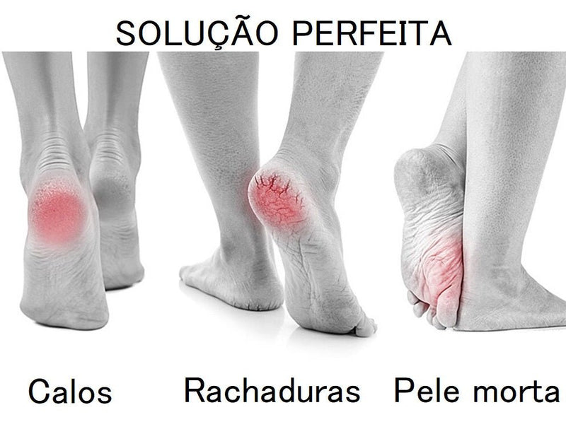 Lixa de pé elétrica portátil esfoliador pedicure - Porto Galem- Com frete grátis